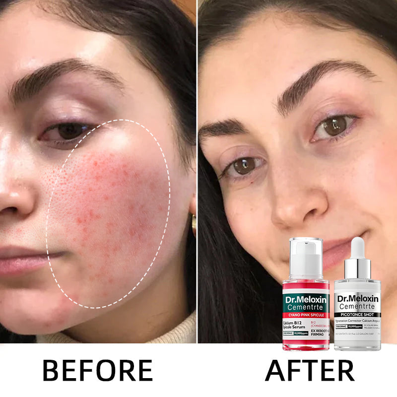 Shrinks Pores & Fades Blemish Marks