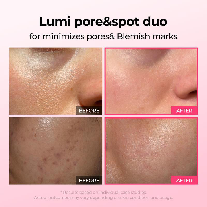 Shrinks Pores & Fades Blemish Marks