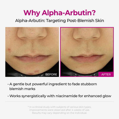 Shrinks Pores & Fades Blemish Marks
