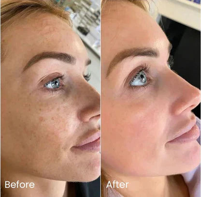 Wrinkles, Dark Spots & Radiant Glow (100 Pads)