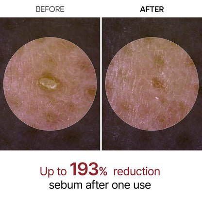 Serums for Brightening, Exfoliating